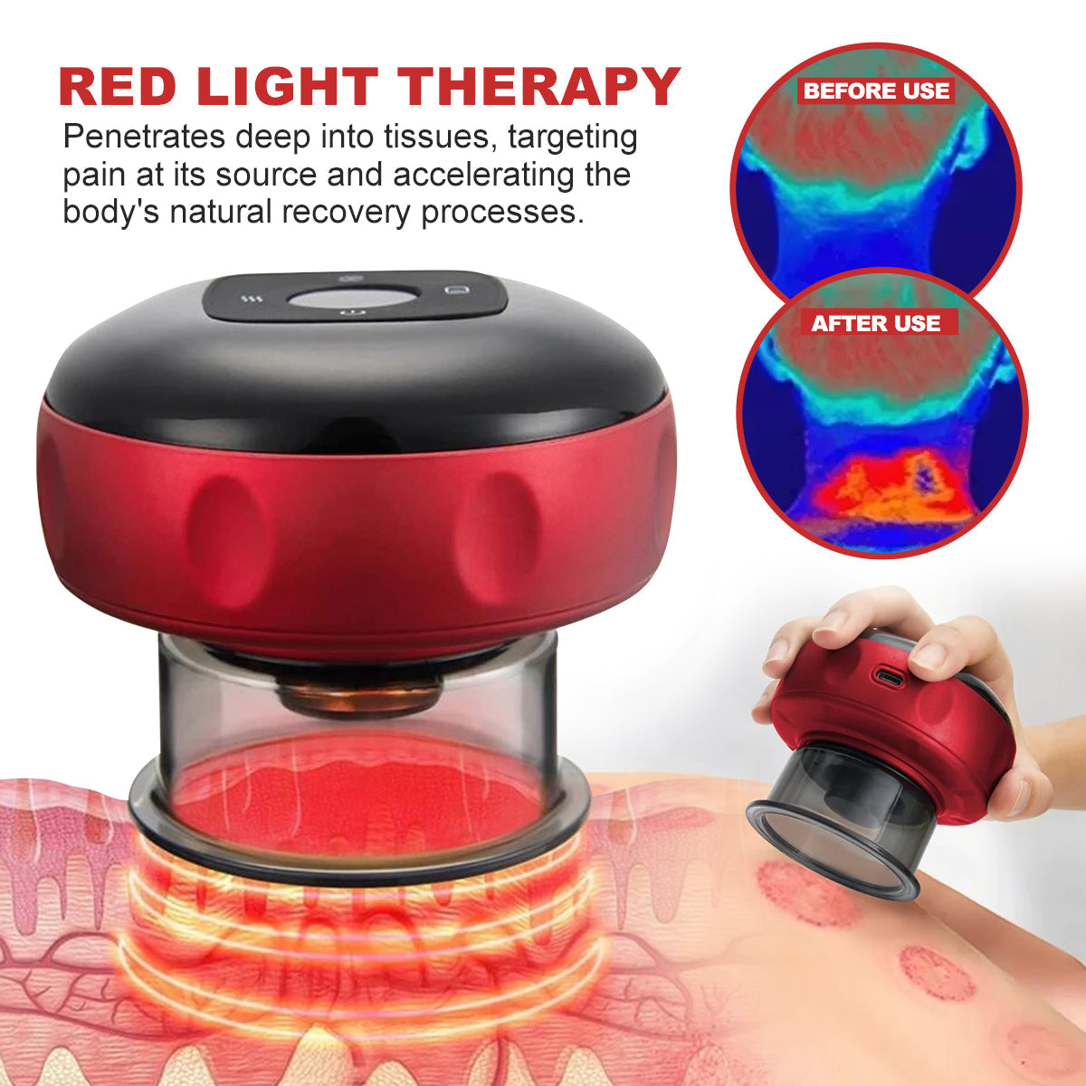 KISSHI Instant Pain Relief Ultimate Cupping Tool
